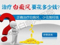 白癜风治疗要花多少钱？